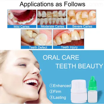 Dinte Adeziv De Umplere Dinți Cavitatea Dentara Asistenta Kit De Instrument De Material Medical Reparații Puternic Grijă Cura De Fixare Rășină De Înlocuire