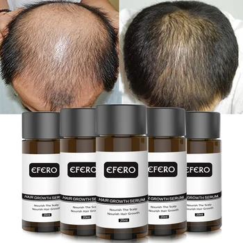 EFERO Ginseng Îngrijirea Părului Esența de Tratament Pentru Bărbați Și Femei, Pierderea Parului Produs Rapid de Crestere a Parului Puternic Ser de Reparare a Parului