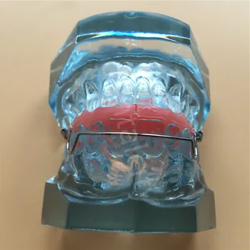 Dentare Funcționale Ortopedice Bionator Detașabil Model 3006 Dentare Învăța Studiu Dinți Model