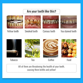 OMYLADY Albirea Dintilor Esența Praf de Igienă Orală Curățare Ser Indeparteaza Placa Petele de Albire a Dintilor Dentare, Instrumente Dentare de Îngrijire
