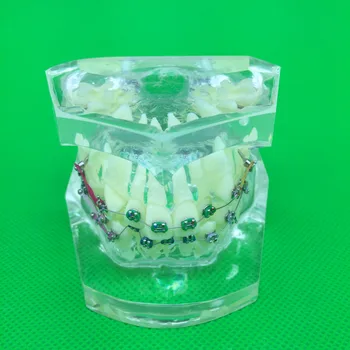 1 BUC Dentare Ortodontice Model de Studiu Transparent Dinți Malocluzie Ortodontic Model Colorat Cu Paranteze&de Vânzare Fierbinte pentru Predare