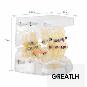 1 BUC Dentare Ortodontice Model de Studiu Transparent Dinți Malocluzie Ortodontic Model Colorat Cu Paranteze&de Vânzare Fierbinte pentru Predare