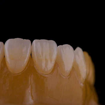 Implant dentar Boala HaHaSmile UT-Multistrat-A3.5 98 Cu Restaurarea Podului Dinte La Dentist Pentru Știința Medicală Dentară
