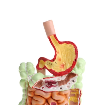 Minify 1X Omului Intestinul gros, Stomacul Patologice Modelul Medical de Predare Laborator Demonstrarea Livrărilor