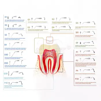 Dentare, Detartraj cu Ultrasunete Sfat Scalare Parodontologie Endodontie se Potrivesc EMS Ciocănitoarea G1 G2 G3