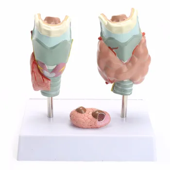 Omului Anatomice Patologie Tiroidiană Anatomie Modelul De Predare De Înaltă Calitate